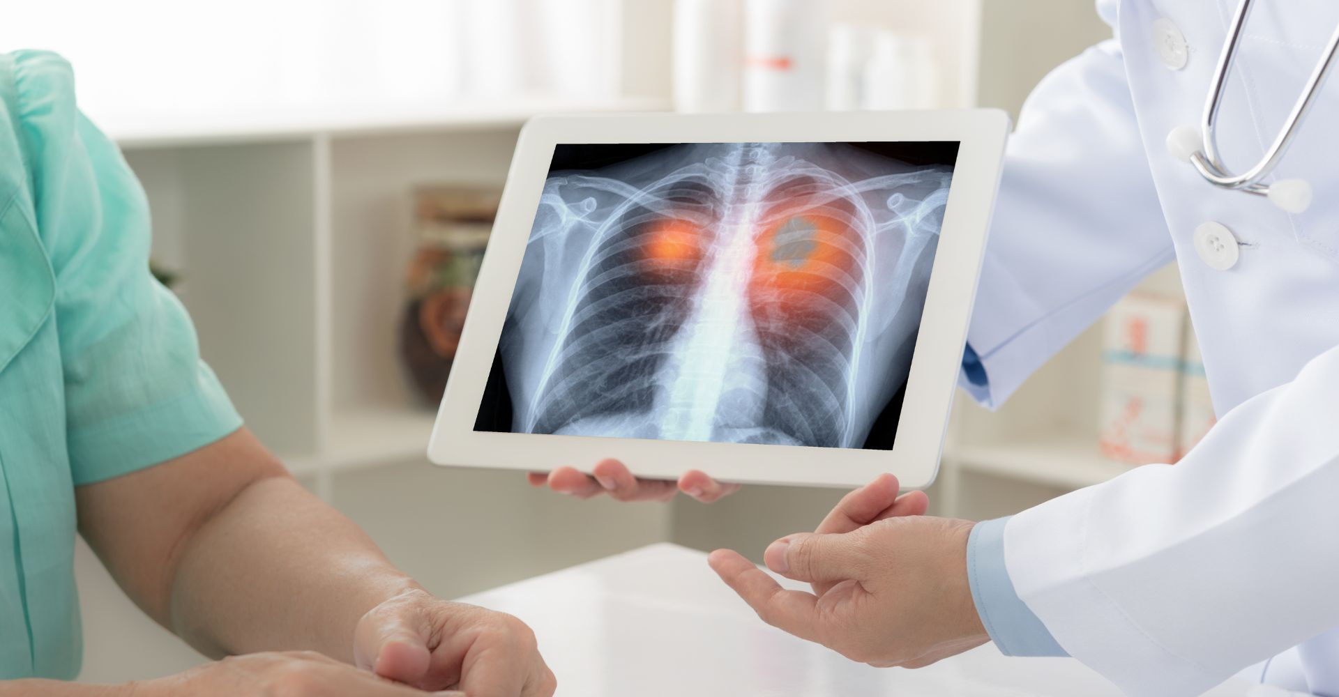 GI Cancer Treatment by Dr Vijay Bansal