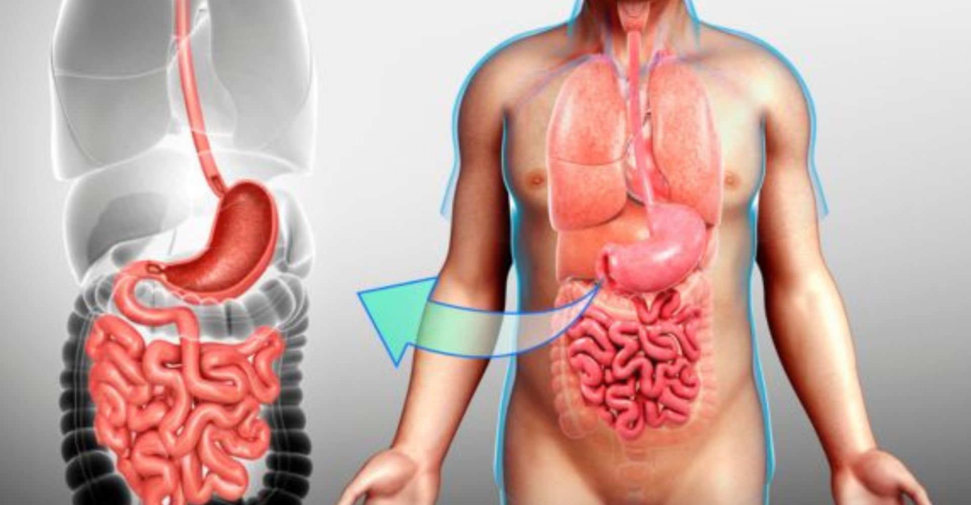 Esophageal Cancer Surgery by Dr Vijay Bansal